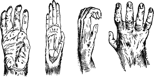 Hand of Gorilla, Orang, Gibbon, and Chimpanzee.
