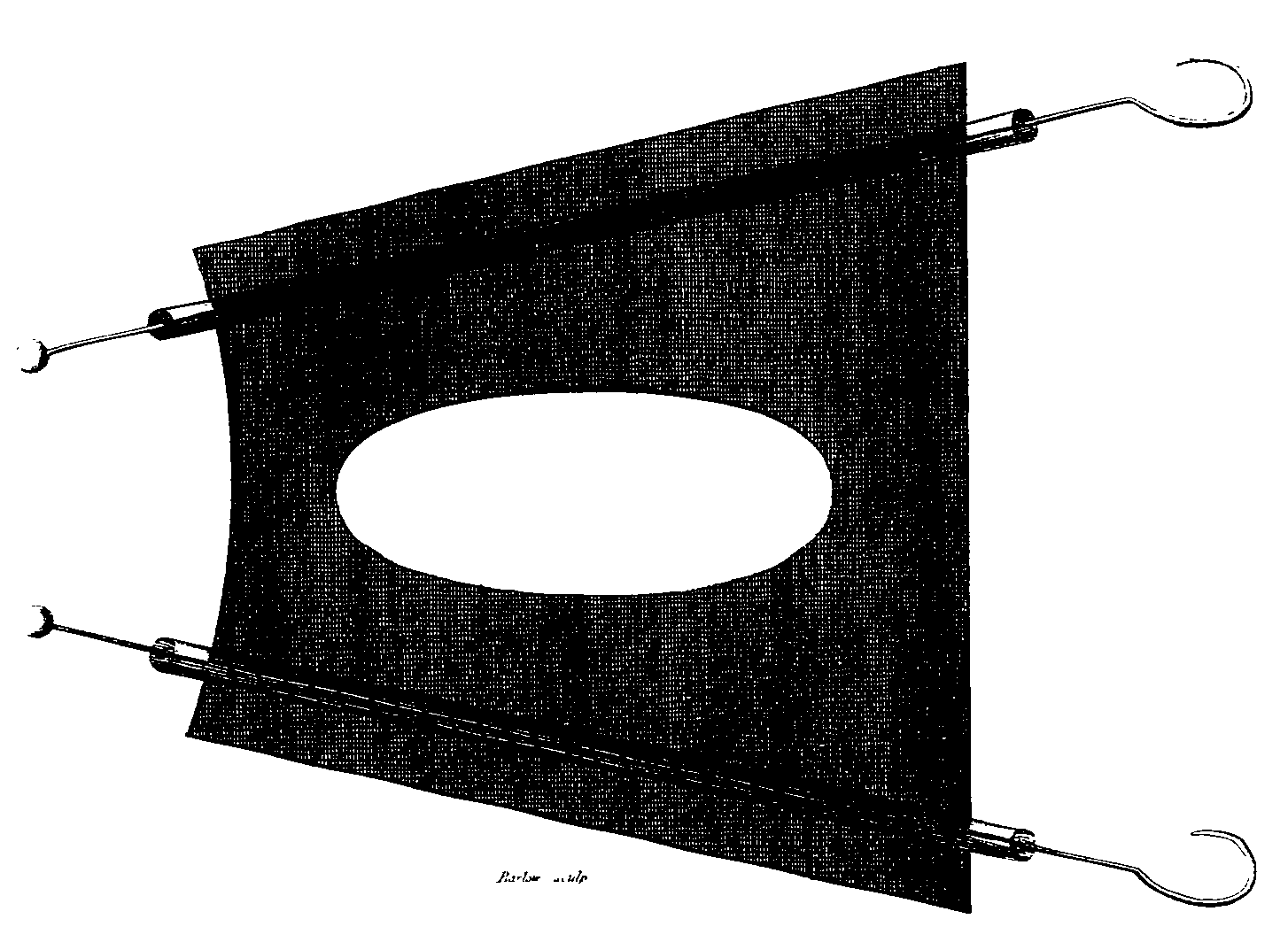 Device for applying electric shocks to a tumour.