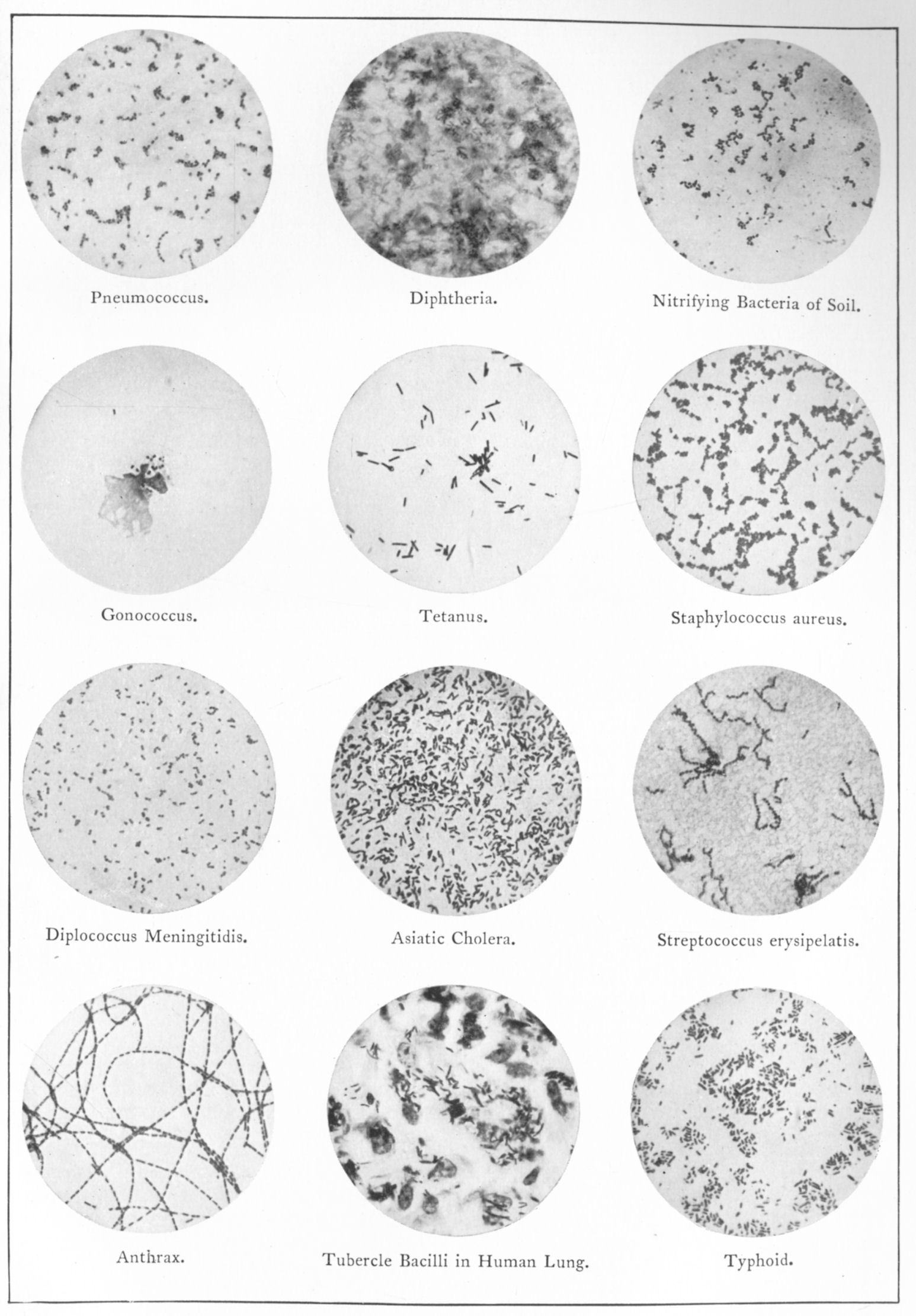 Bacteria