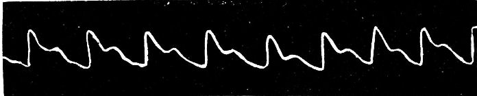 Fig. 30.--The Form of the Pulse.