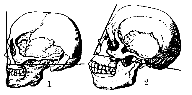 Facial Angle