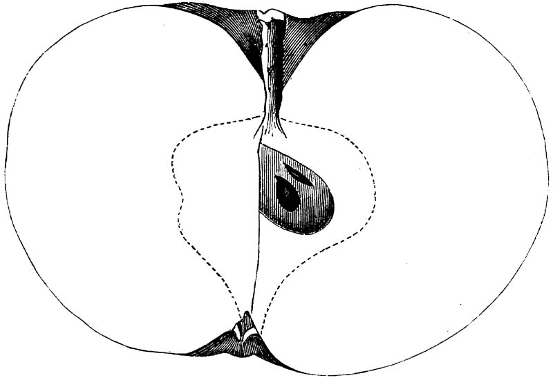 Figure 126.