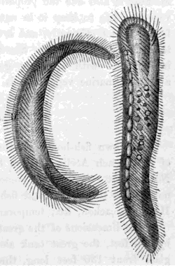 KONDYLOSTOMA PATENS (MAGNIFIED 300 TIMES).