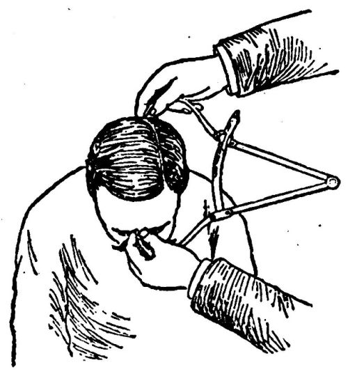 Head Length Measurements.