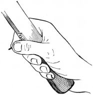 Fig. 62.—Shingler's Hand.