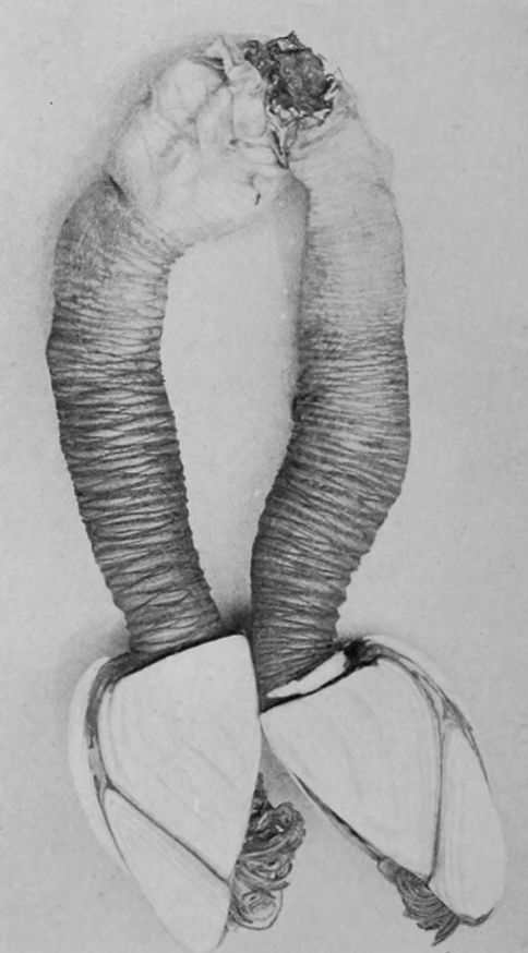 A PAIR OF BARNACLES.