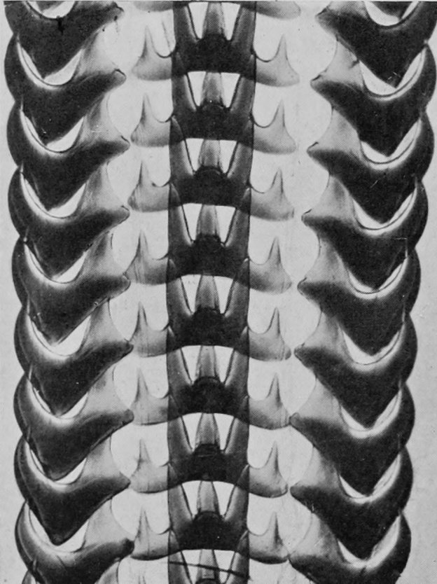 HIGHLY MAGNIFIED TONGUE OF A SEA-SNAIL.