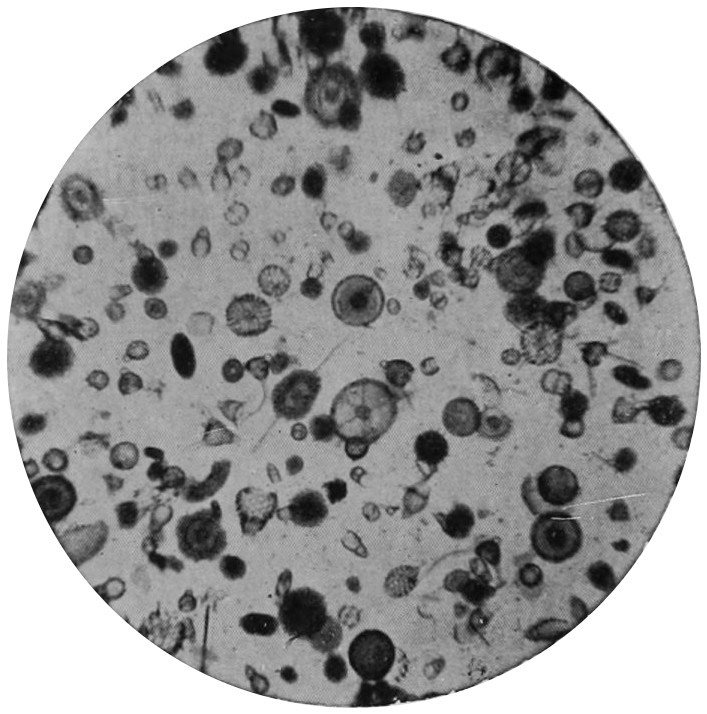 POLYCYSTS.